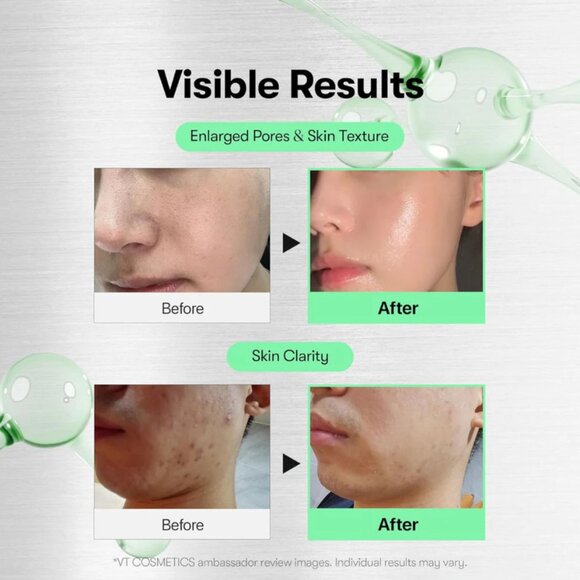 VT Reedle Shot 100 - Picture 4 of 5